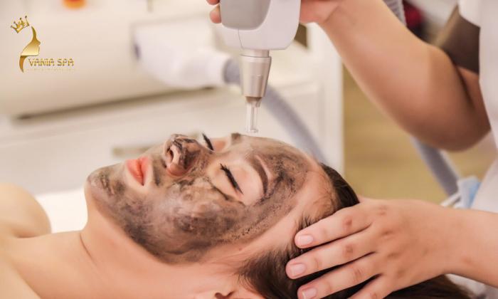 Laser Carbon - Trẻ Hóa Da Tầng Sâu