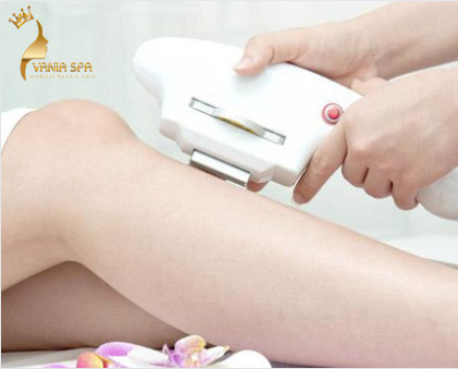 Triệt lông vĩnh viễn