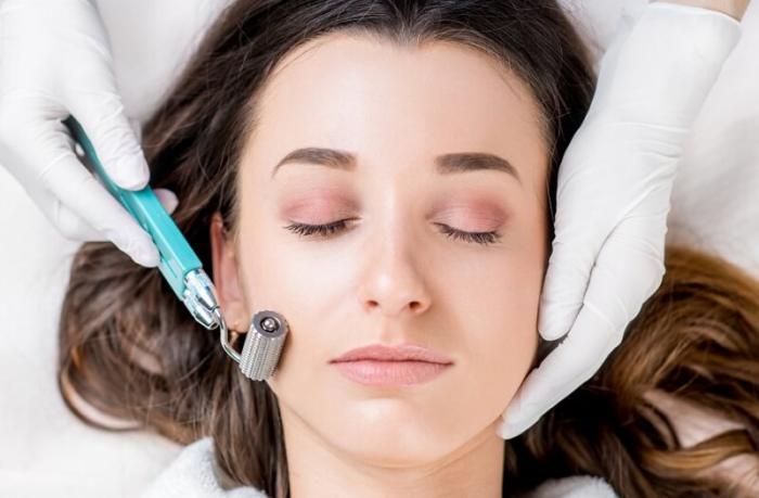 Lắp đầy sẹo rỗ, tái tạo làn da bằng phương pháp bóc tách dáy sẹo và lăn kim