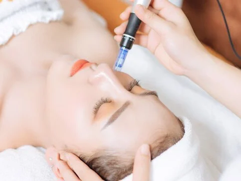 Phi kim da trắng khỏe