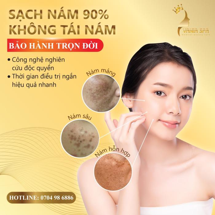 NƠI ĐIỀU TRỊ NÁM HIỆU QUẢ QUẬN TÂN BÌNH