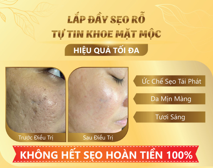 sẹo